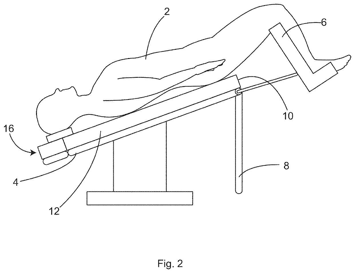 Patient Securement System for the Surgical Trendelenburg Position