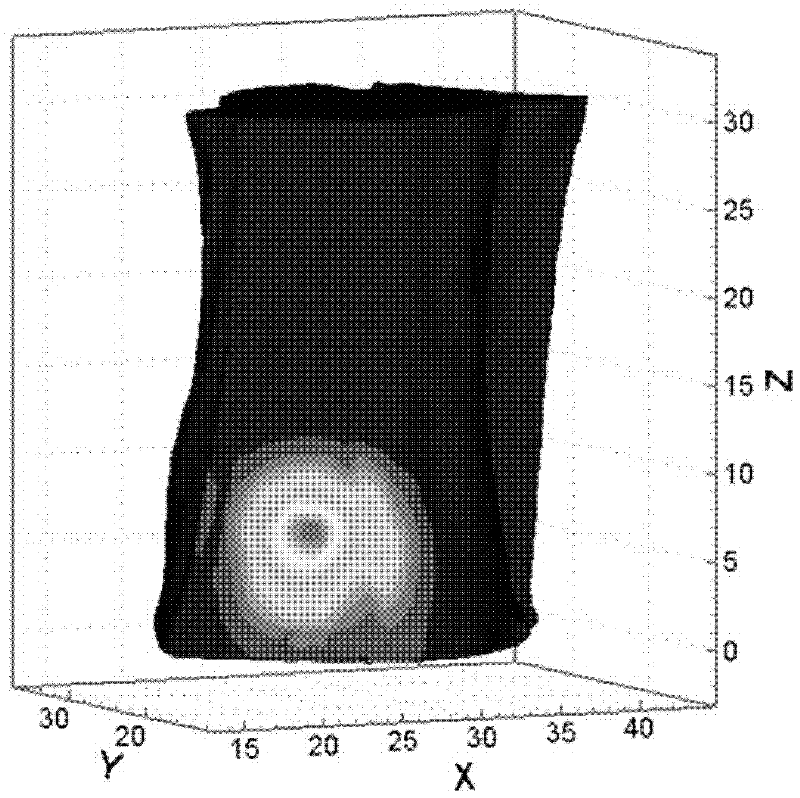 Bimodal fusion tomography method based on iterative shrinkage