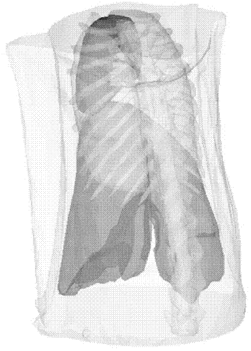 Bimodal fusion tomography method based on iterative shrinkage