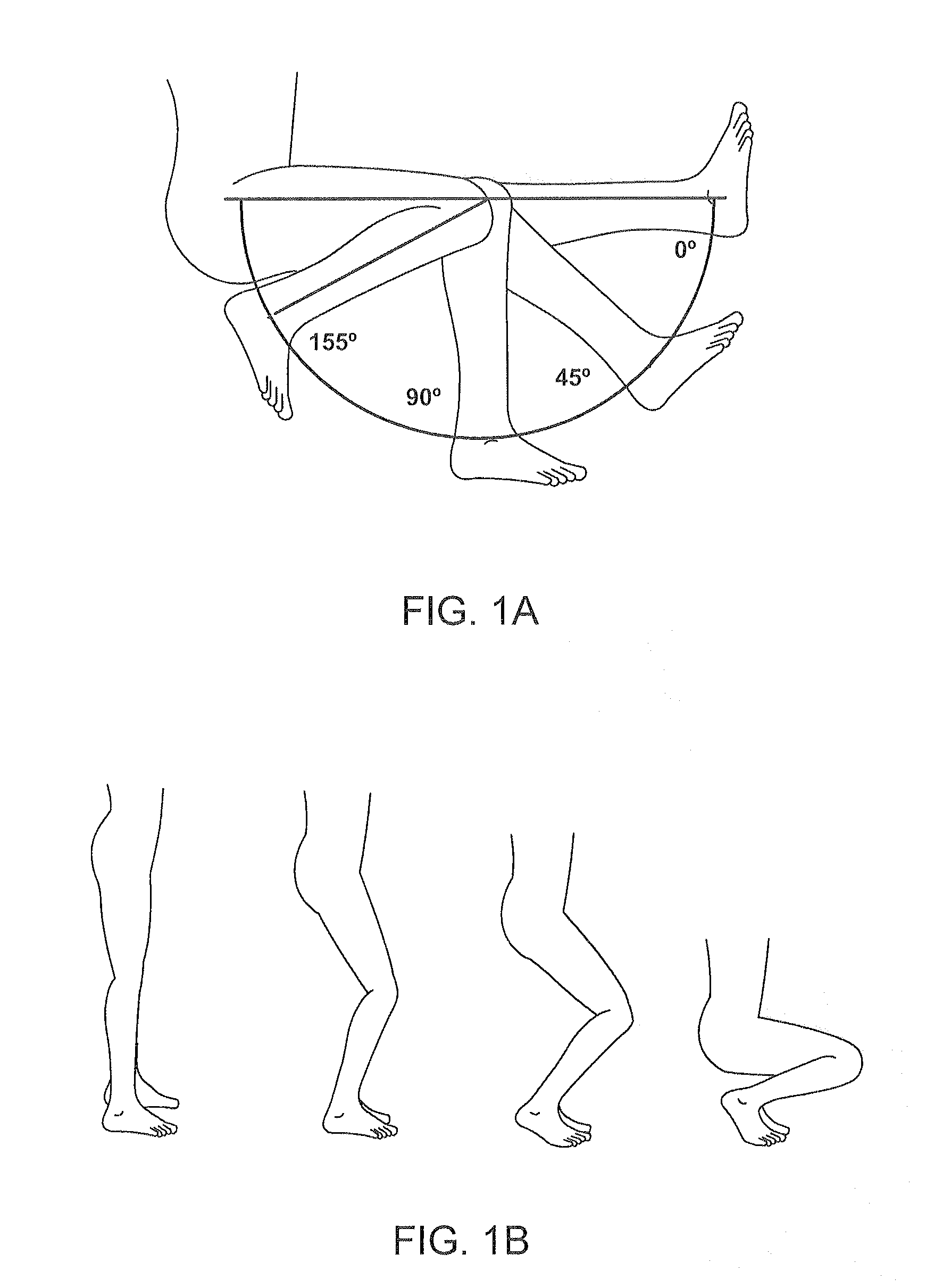 Systems and methods for providing a femoral component