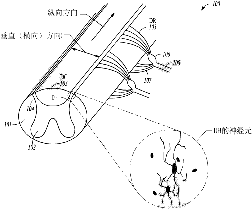 System for determining neurological position of epidural leads