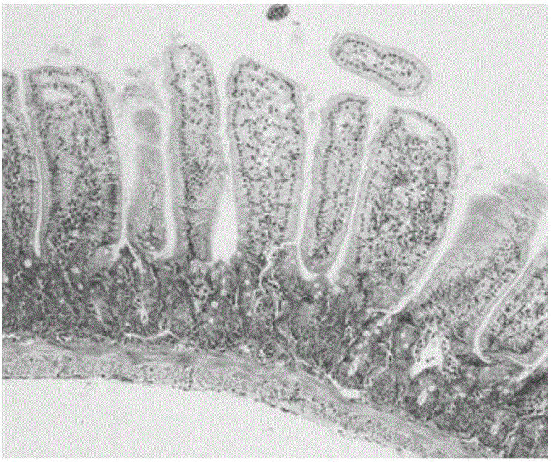 Novel digestive-tract contrast agent and preparing method thereof