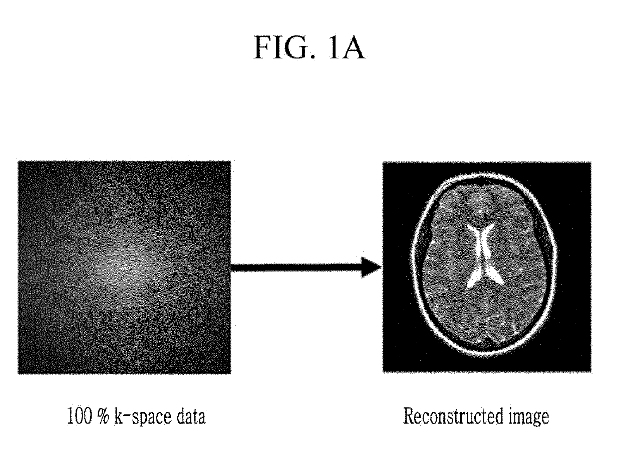 Apparatus and method for reconstructing magnetic resonance image using learning, and under-sampling apparatus method and recording medium thereof