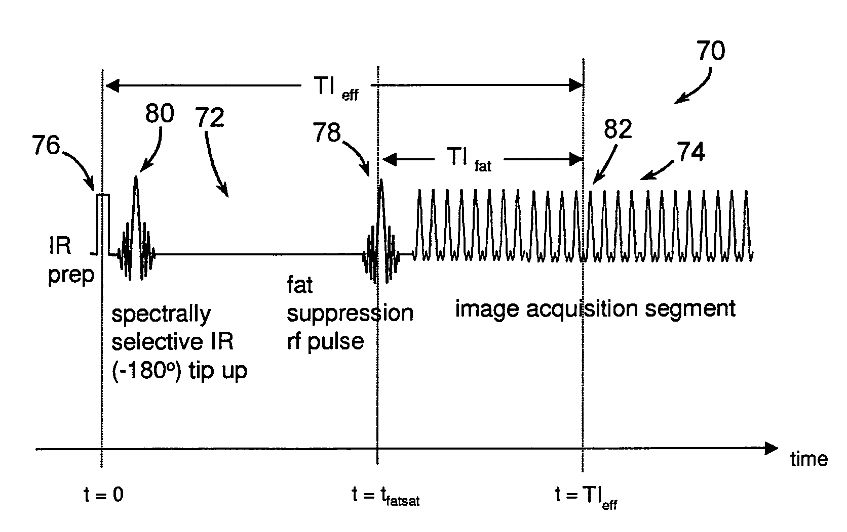 Method and system of MR imaging with simultaneous fat suppression and T1 inversion recovery contrast