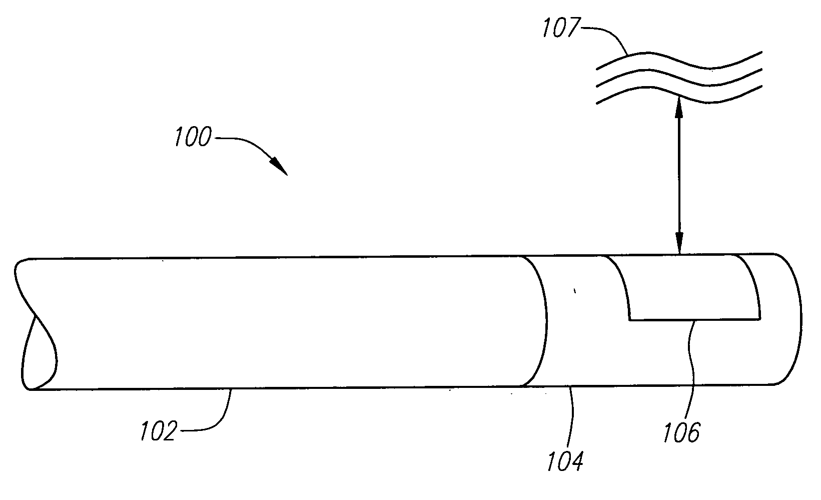 Piezocomposite transducers