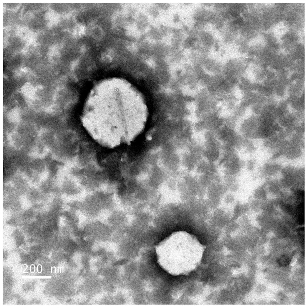 Iodine oil emulsion or drug-loaded iodine oil emulsion as well as preparation method and application thereof