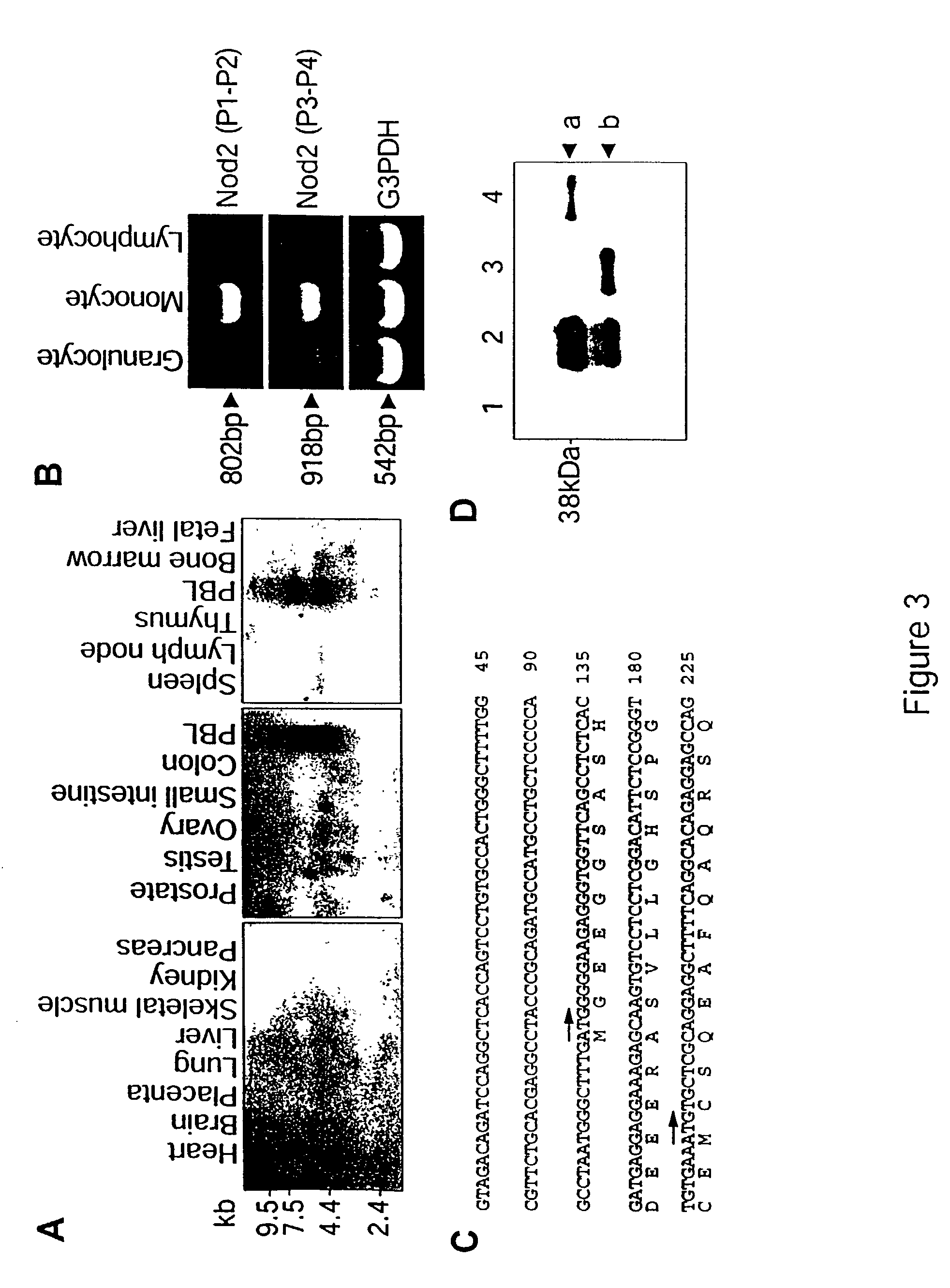 Modulators on Nod2 signaling