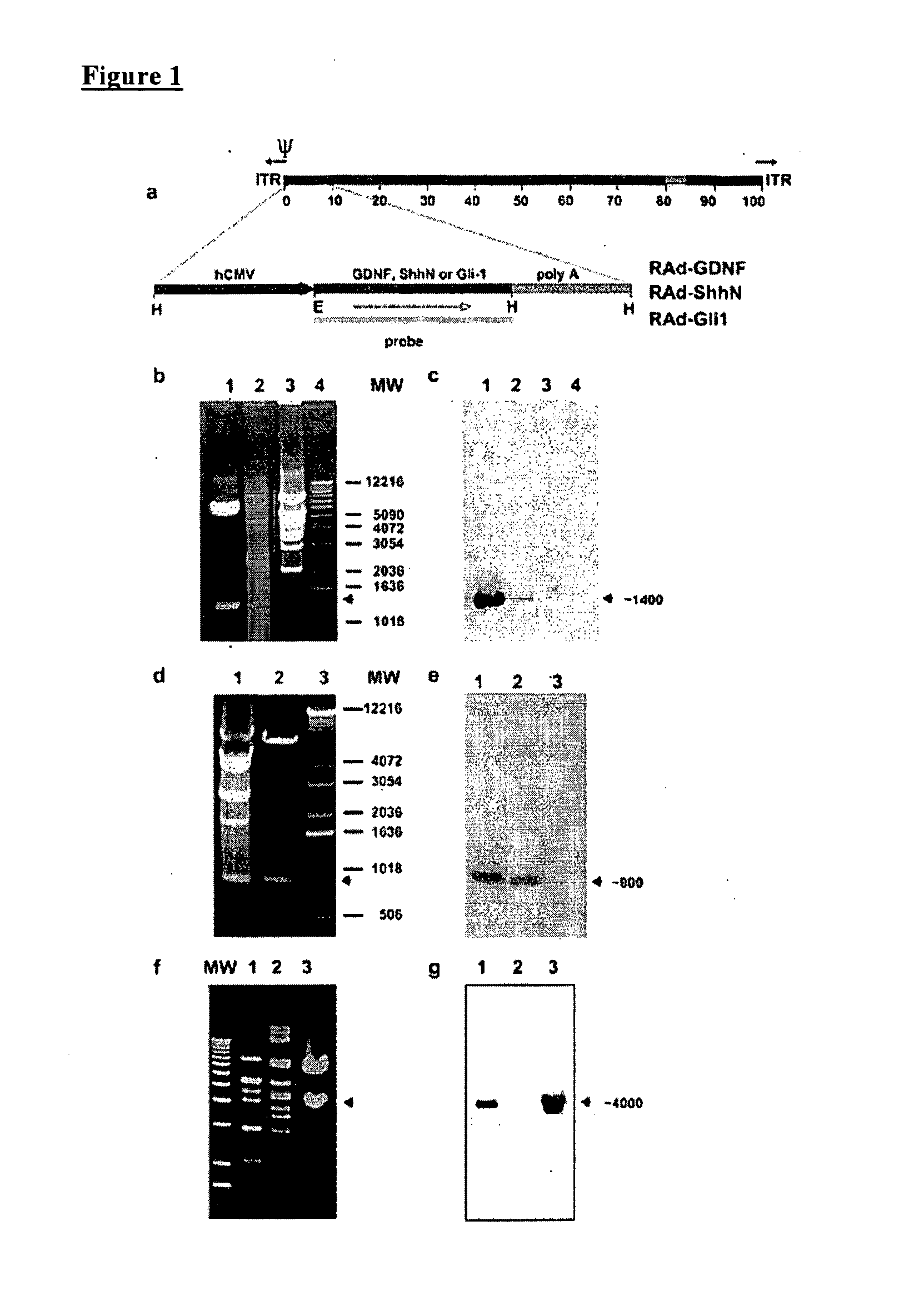 Treatment of Parkinson's Disease and Related Disorders