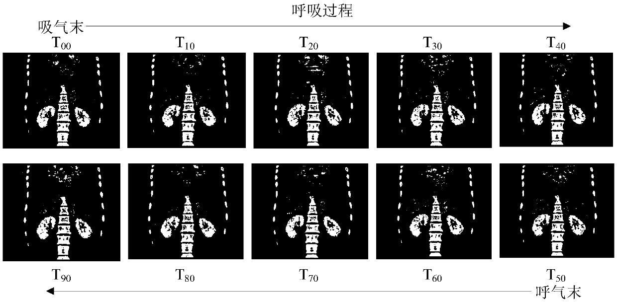 Breathing exercise correction method and device, computer device and storage medium