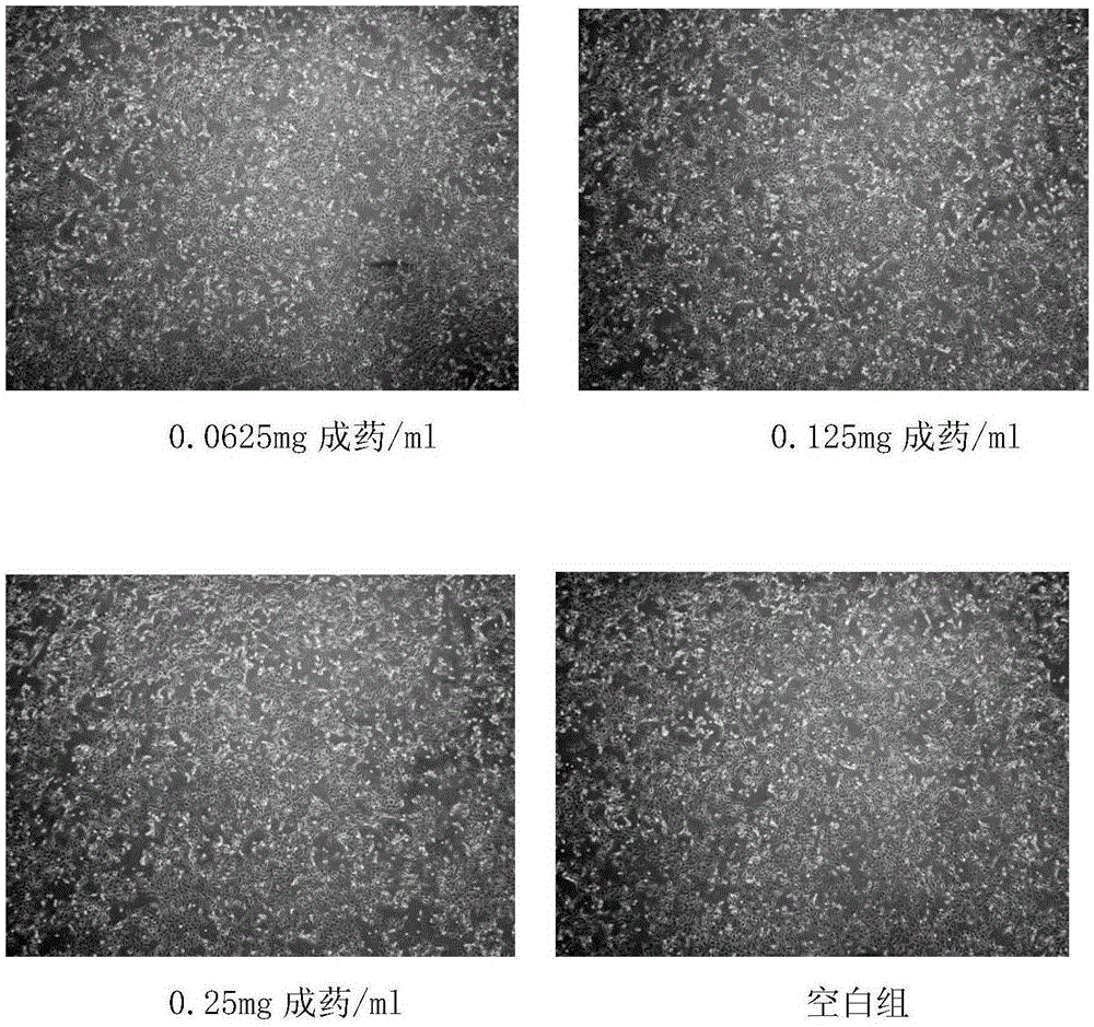 Brain nourishing and vessel dredging traditional Chinese medicine for promoting neural stem cell proliferation and preparation method of traditional Chinese medicine