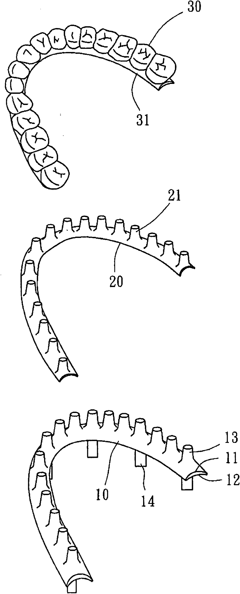 Artifical teethridge and fang