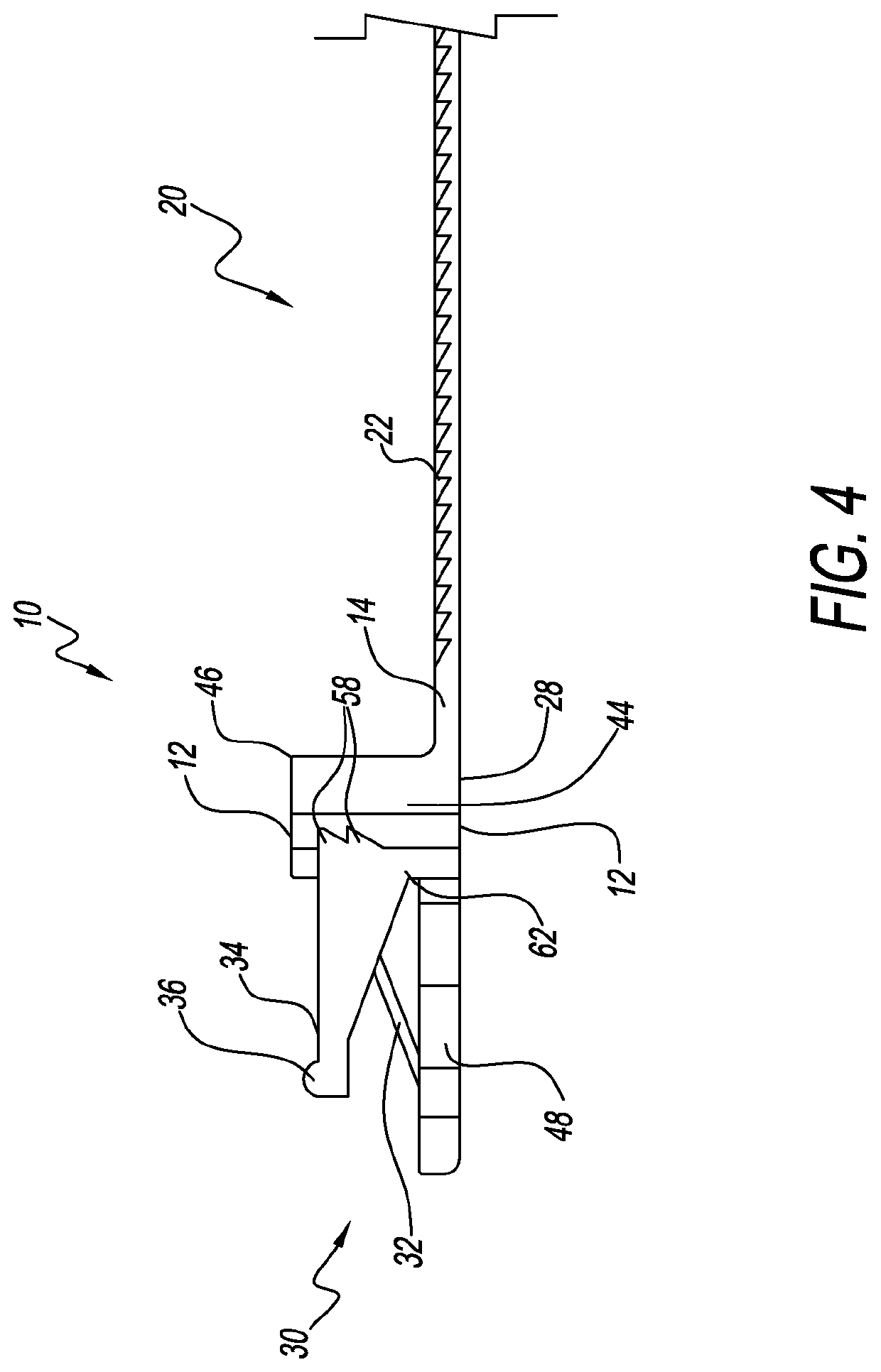 Releasable cable tie