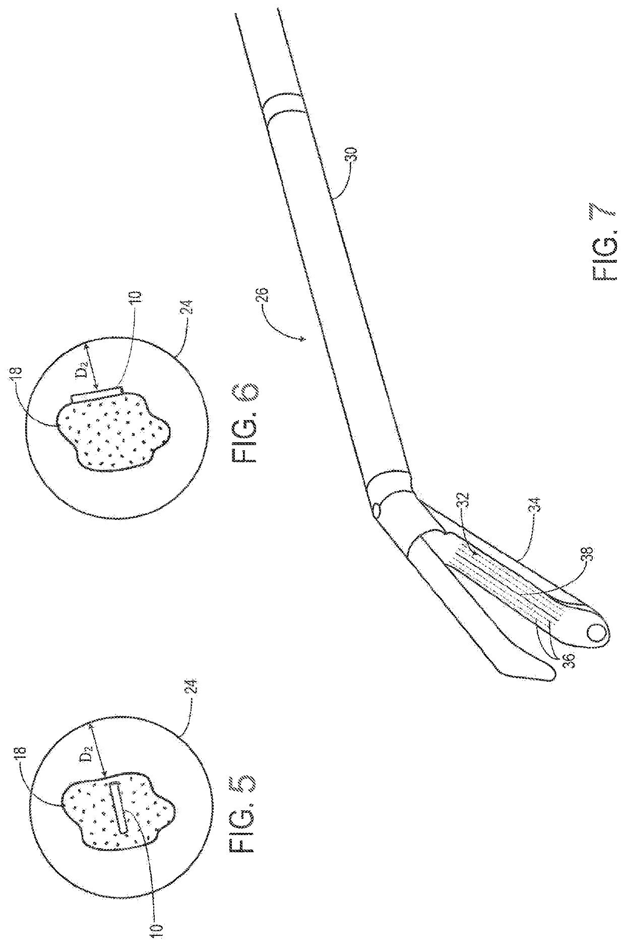 System and method for a tissue resection margin measurement device