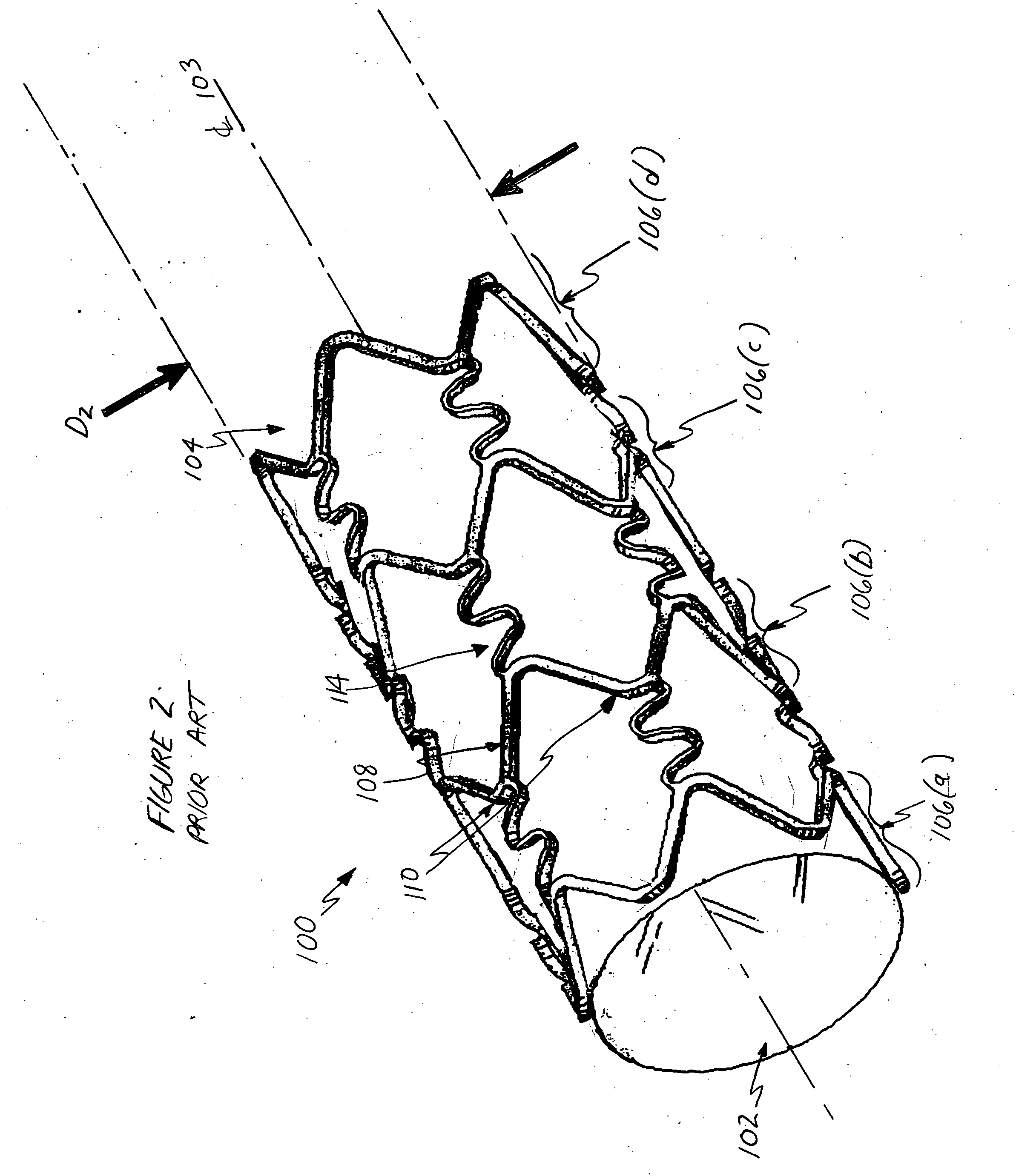 Optimized flex link for expandable stent