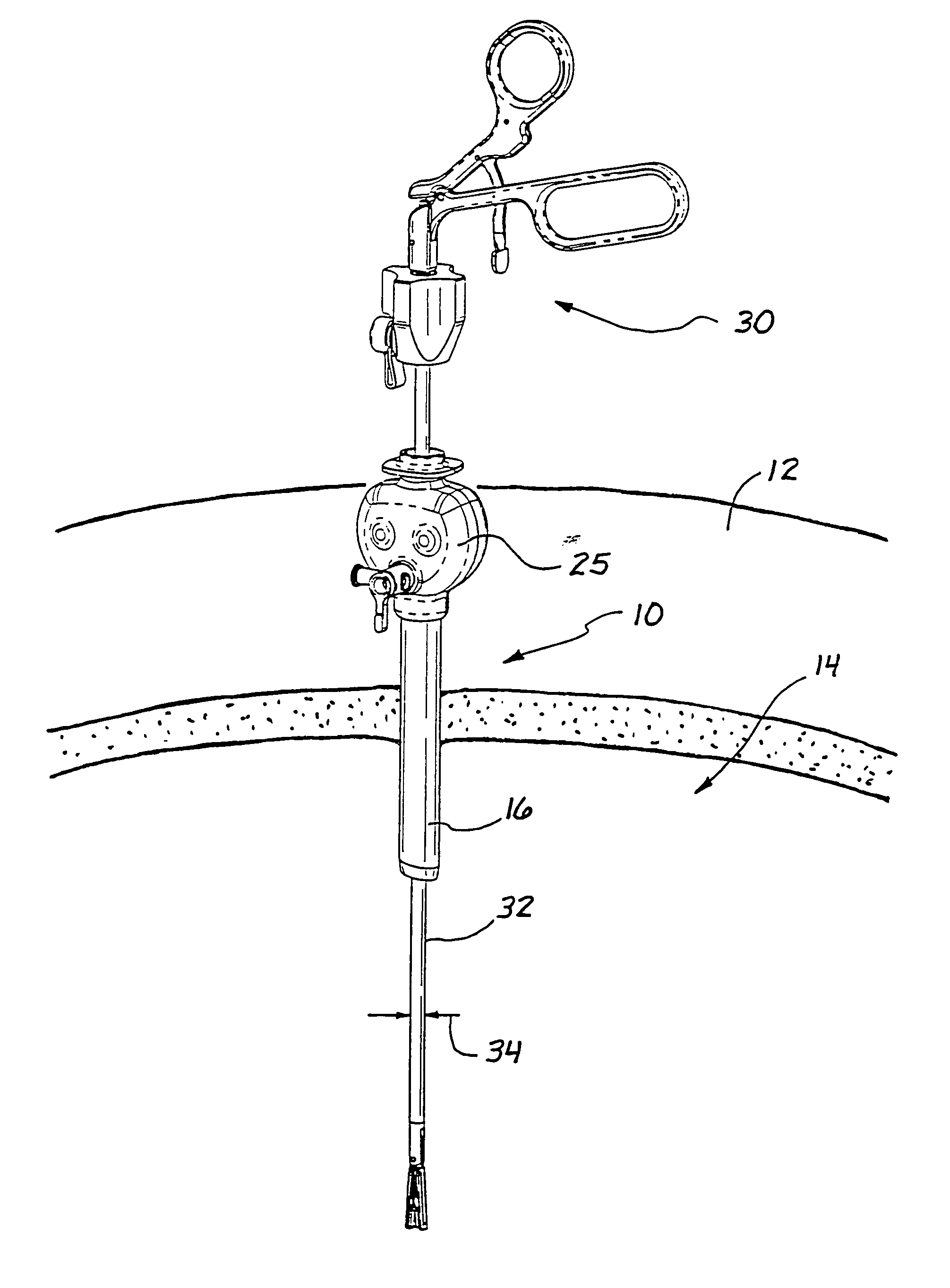 Access sealing apparatus and method