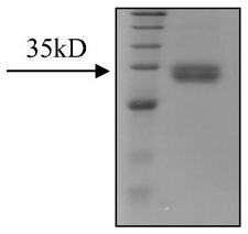 Medical use and medicinal composition of VSIG3 small-molecule inhibitors