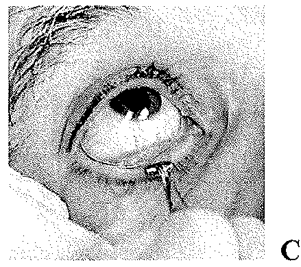 Bimatoprost Ocular Silicone Inserts and Methods of Use Thereof