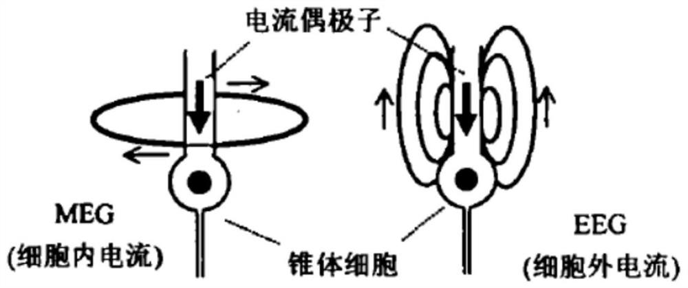 Brain structure imaging system and method based on MEG and EEG fusion