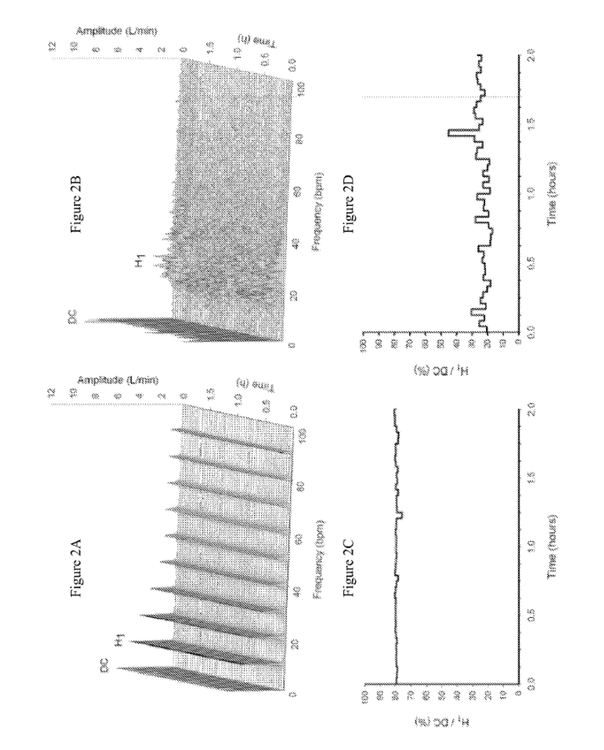 Method and system to detect respiratory asynchrony