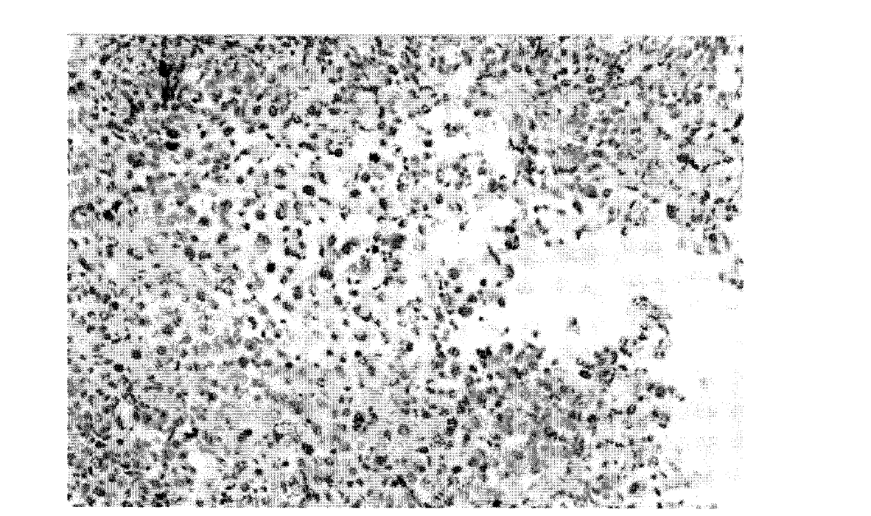 Humanization tumor immune cell cytokines TNTIL2 as well as preparation method and application thereof