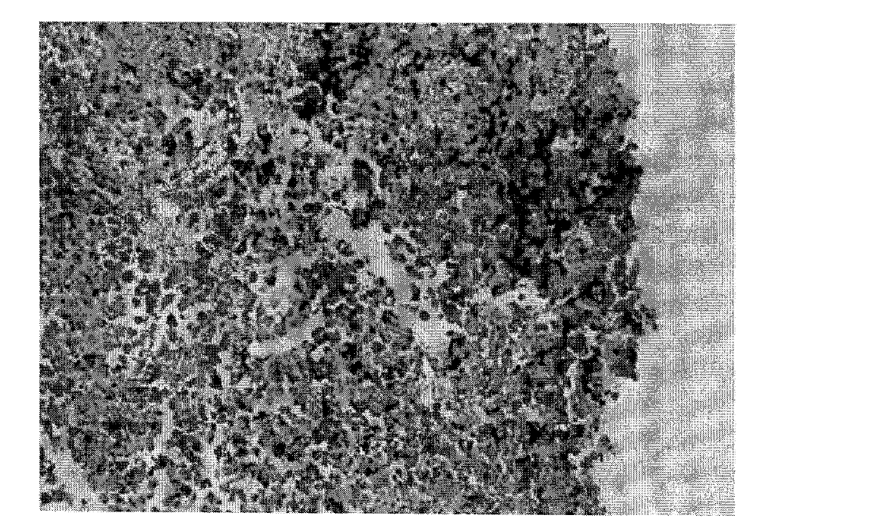 Humanization tumor immune cell cytokines TNTIL2 as well as preparation method and application thereof