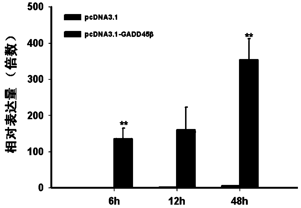 Application of gadd45β gene in preparation of anti-bladder cancer drug