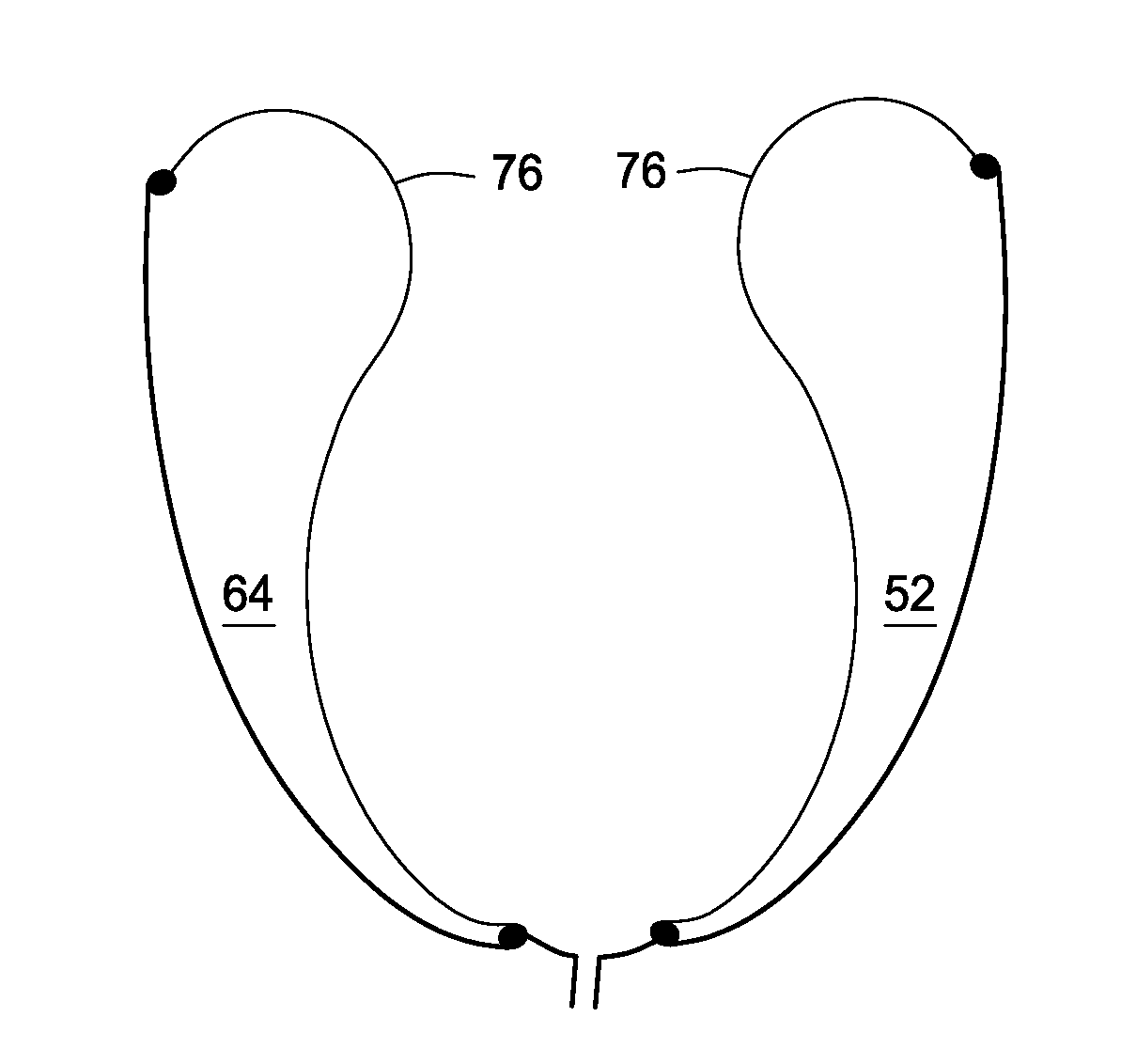 Device for the Modulation of Cardiac End Diastolic Volume