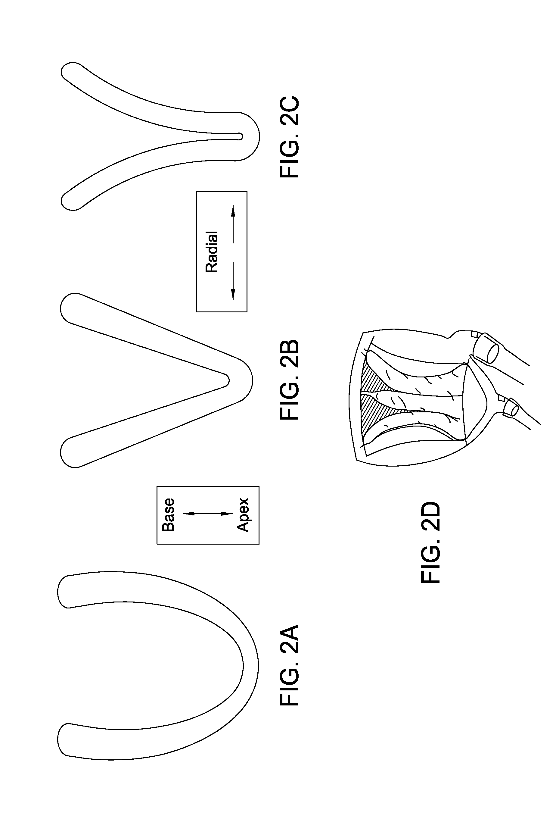 Device for the Modulation of Cardiac End Diastolic Volume