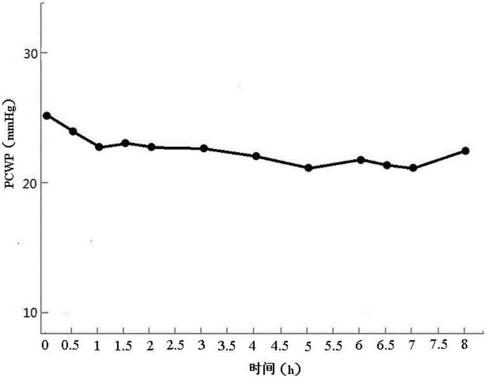 Powder injection for injection and preparation method thereof