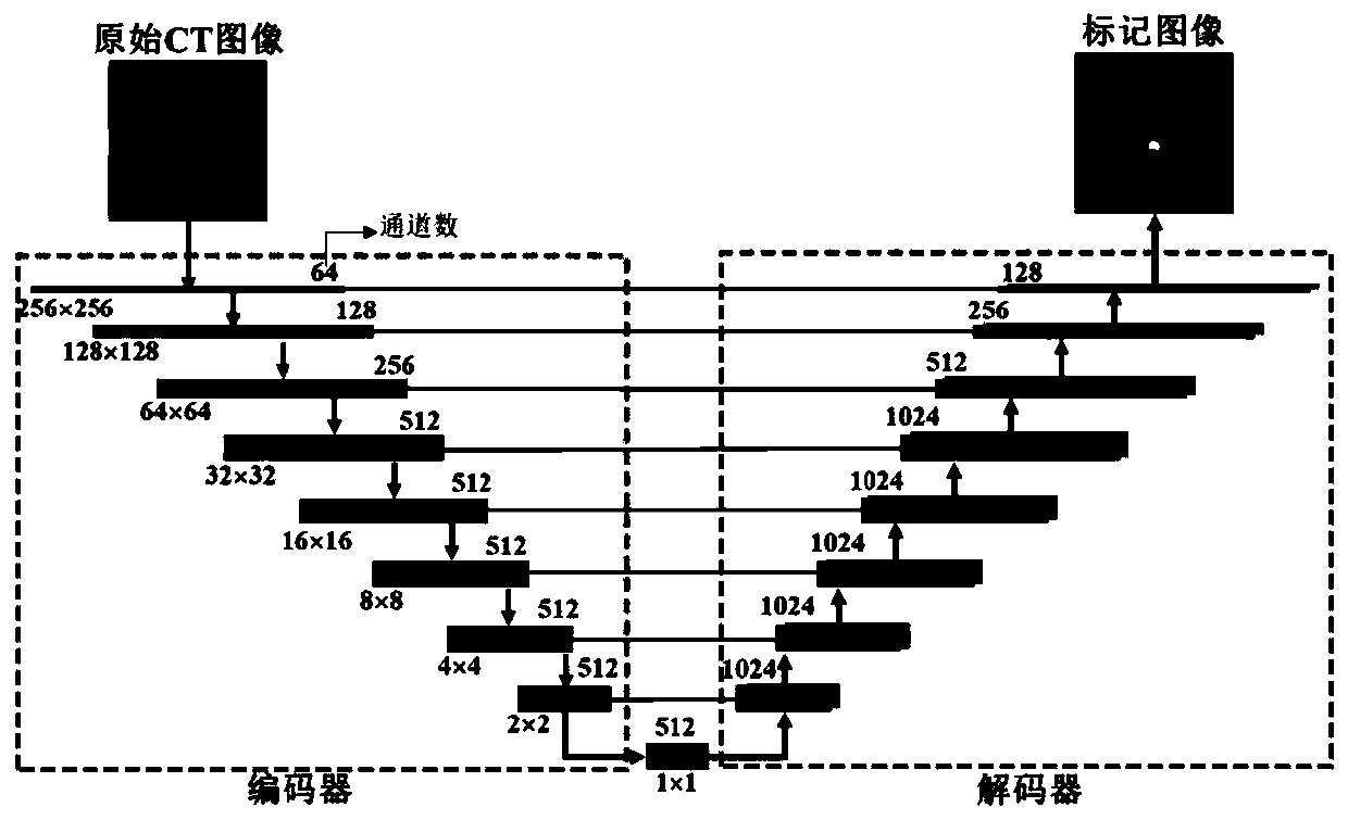 CT image bone condition detection method and device based on convolutional neural network