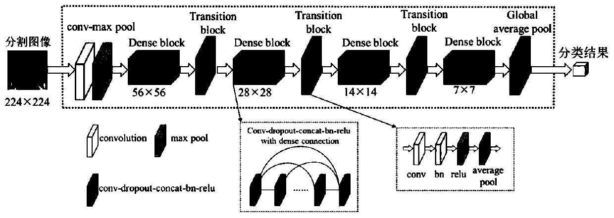 CT image bone condition detection method and device based on convolutional neural network