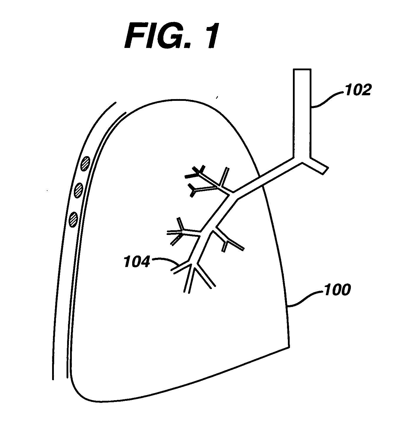 Methods and devices for controlling collateral ventilation