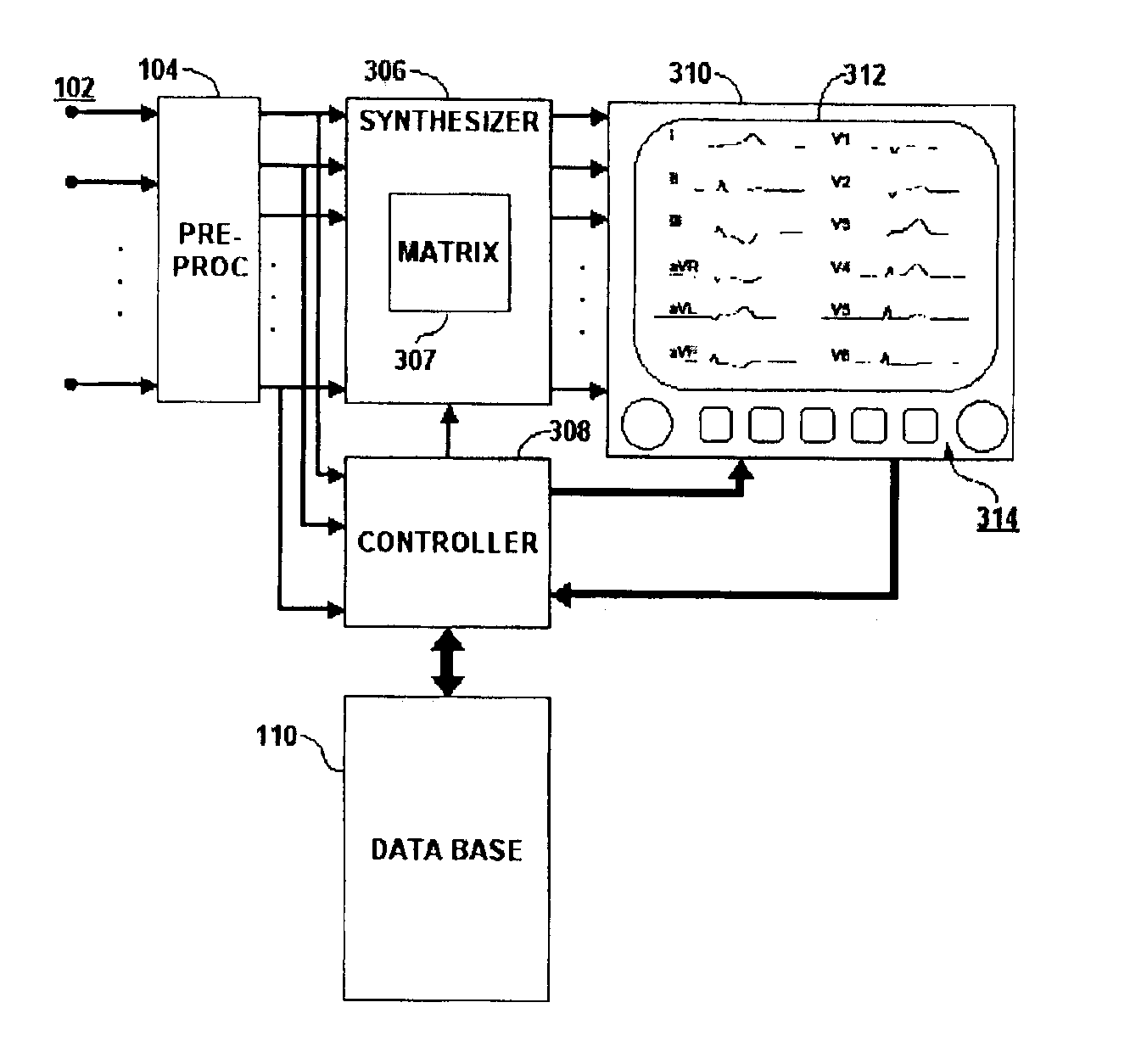 System for adaptively deriving ECG chest lead signal data