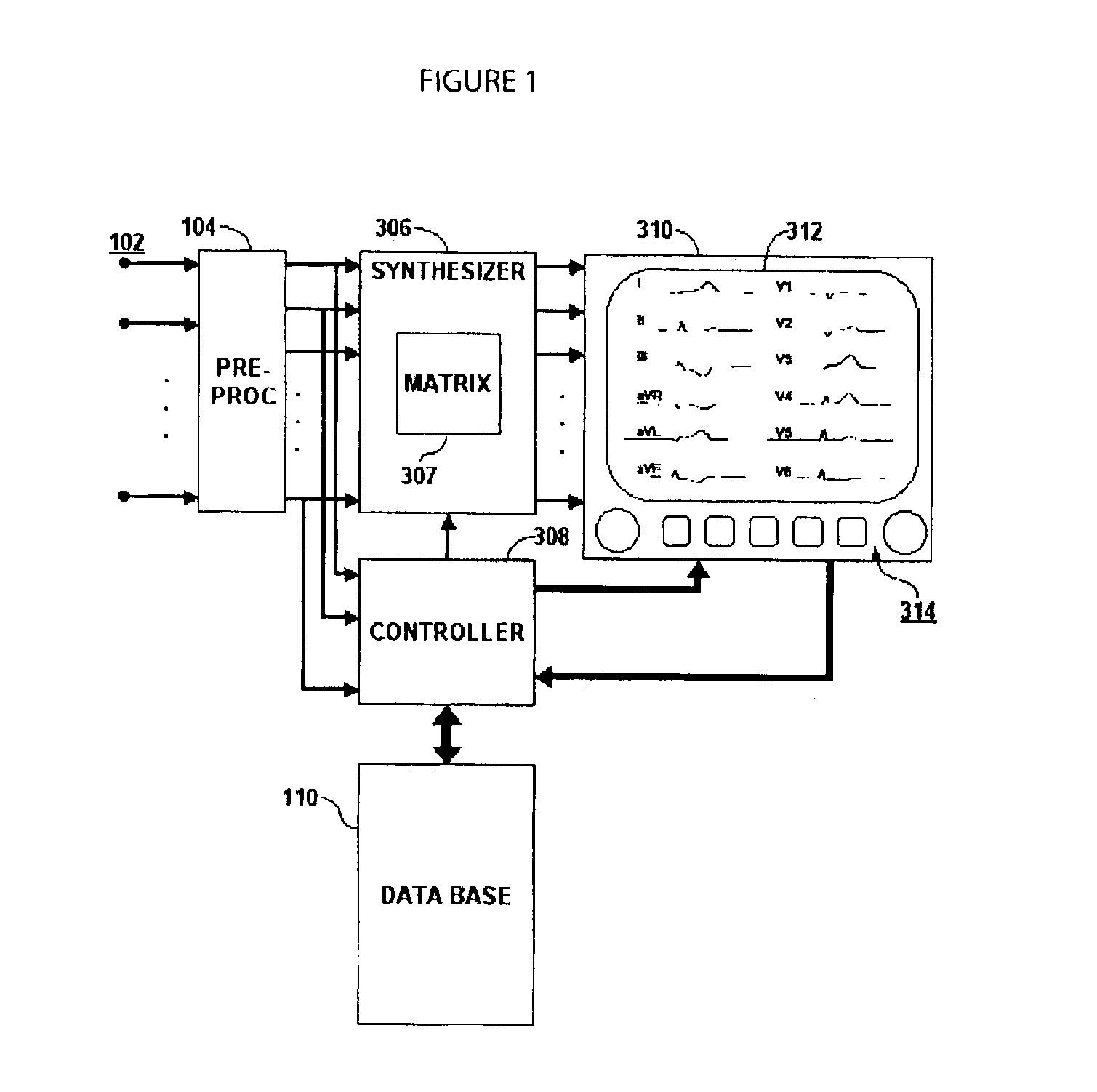 System for adaptively deriving ECG chest lead signal data