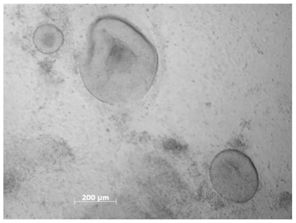 A Simple, Efficient and Mechanizable Induction Method for Differentiation of Human Pluripotent Stem Cells into Retinal Tissue