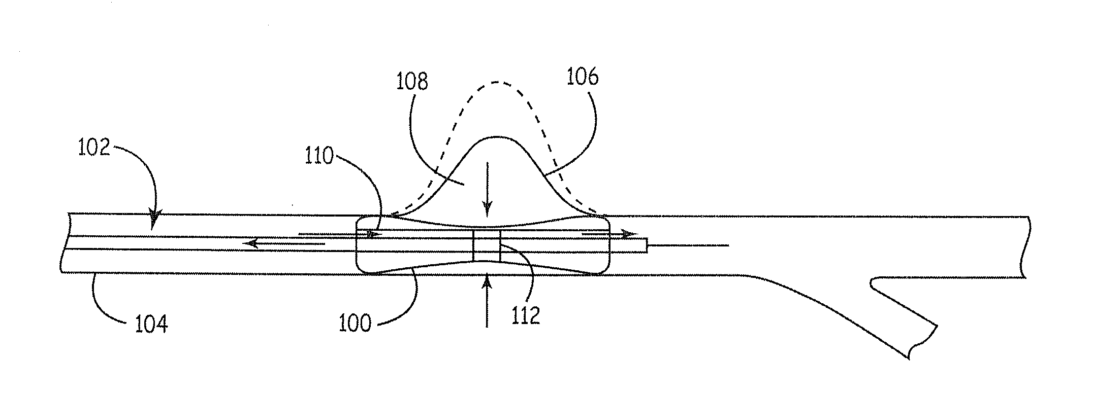 Compositions for tissue stabilization