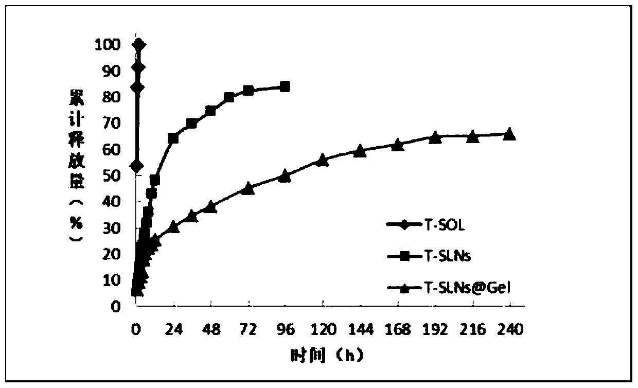 Temozolomide nuclear magnetic resonance visual injectable hydrogel as well as preparation method and application thereof