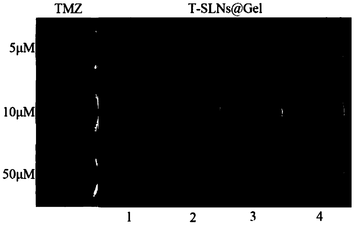 Temozolomide nuclear magnetic resonance visual injectable hydrogel as well as preparation method and application thereof