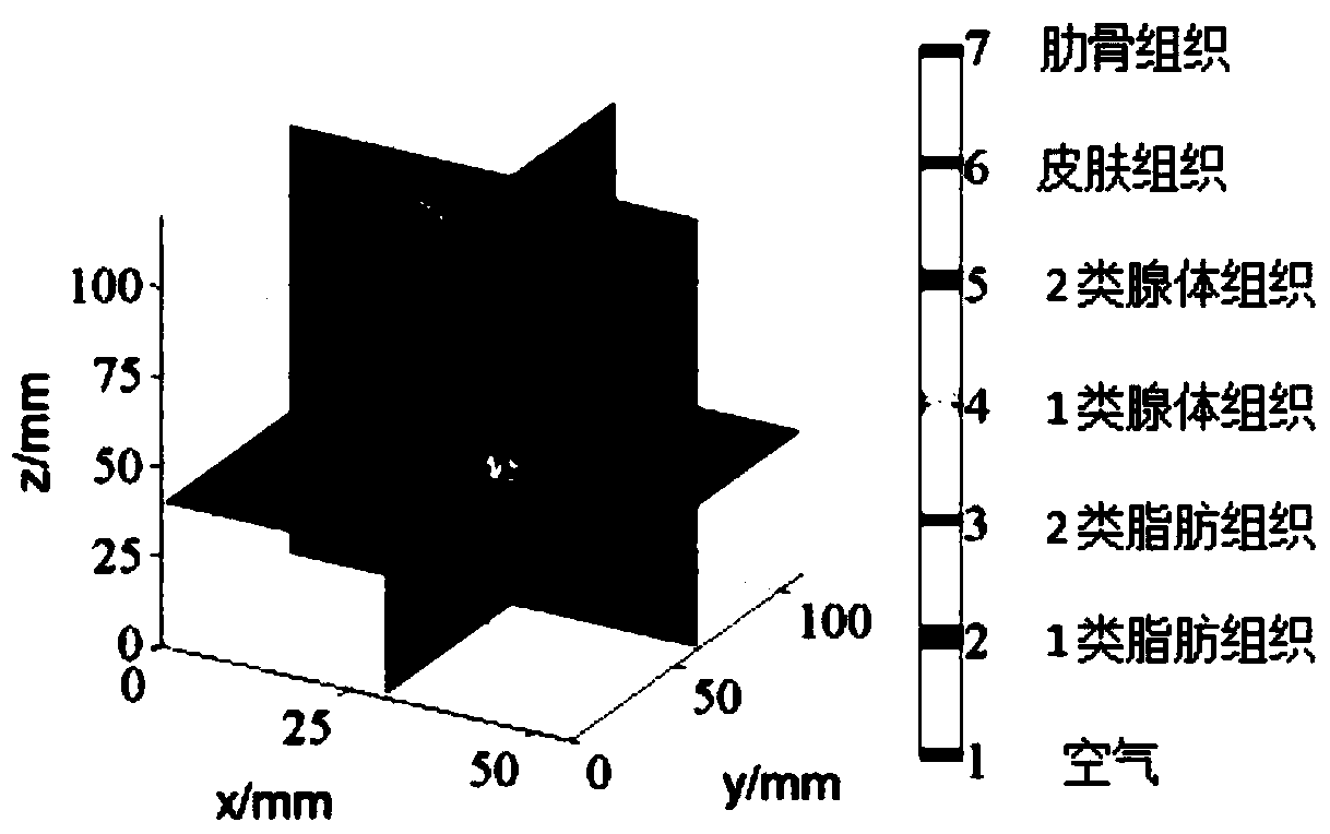 An Ultra-Wideband Breast Tumor Imaging Method Based on Magnetic Resonance Image Compensation