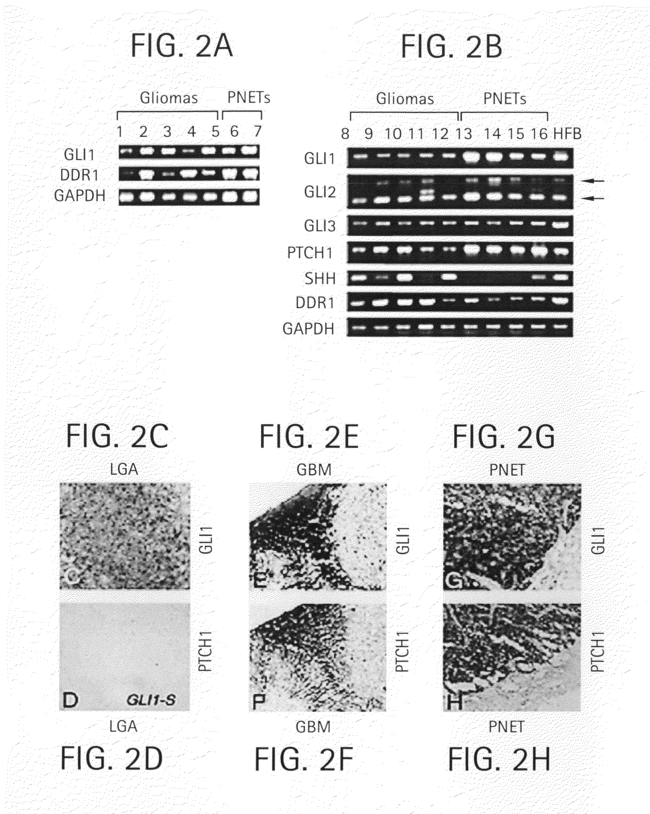 Method and compositions for inhibiting tumorigenesis