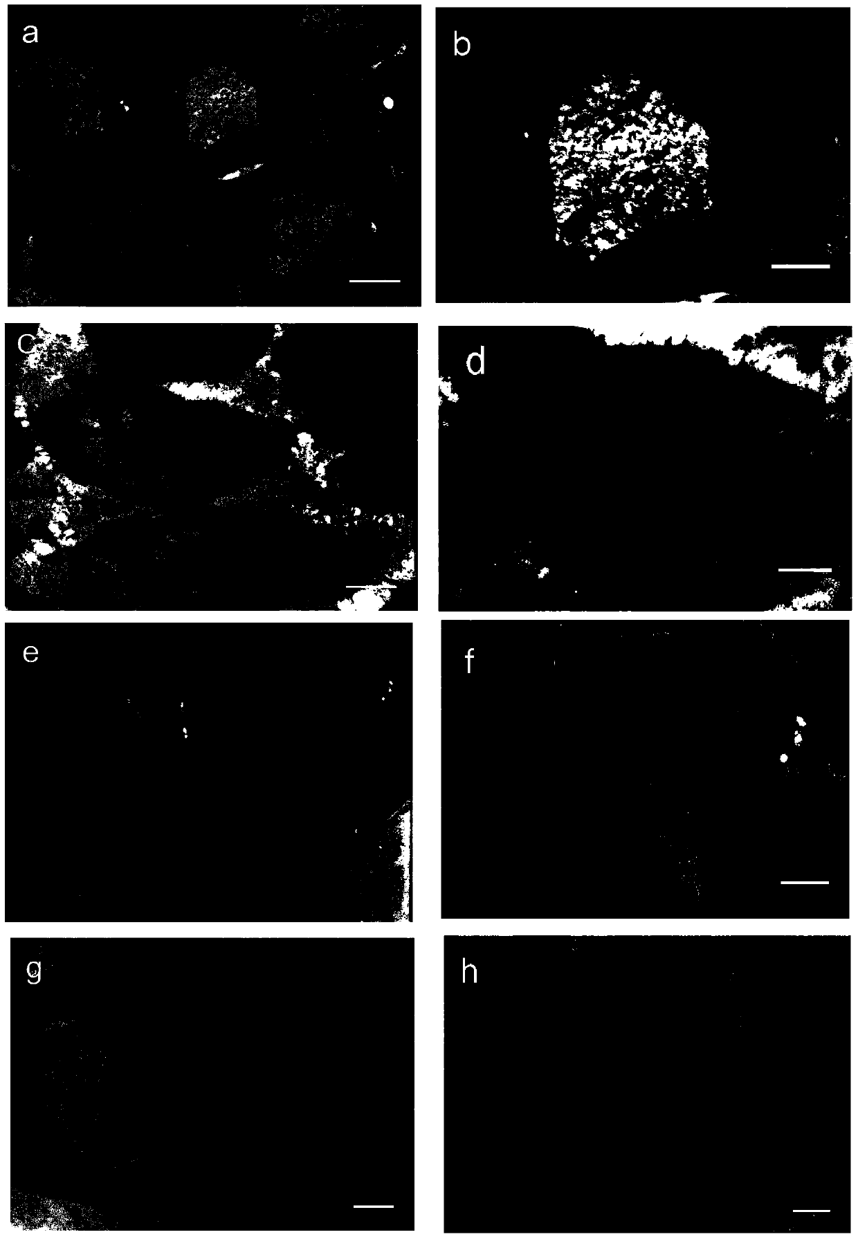 Application of koumine and koumine homolog in preparation of medicines for treating diabetic complications