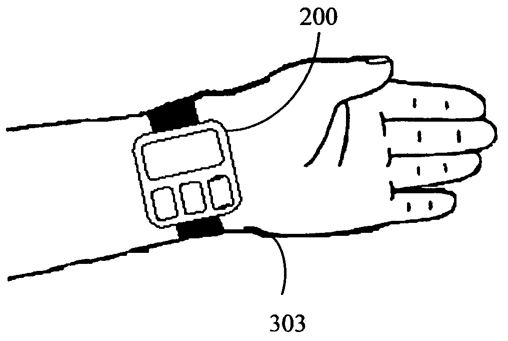 Apparatus and method for alleviating nausea