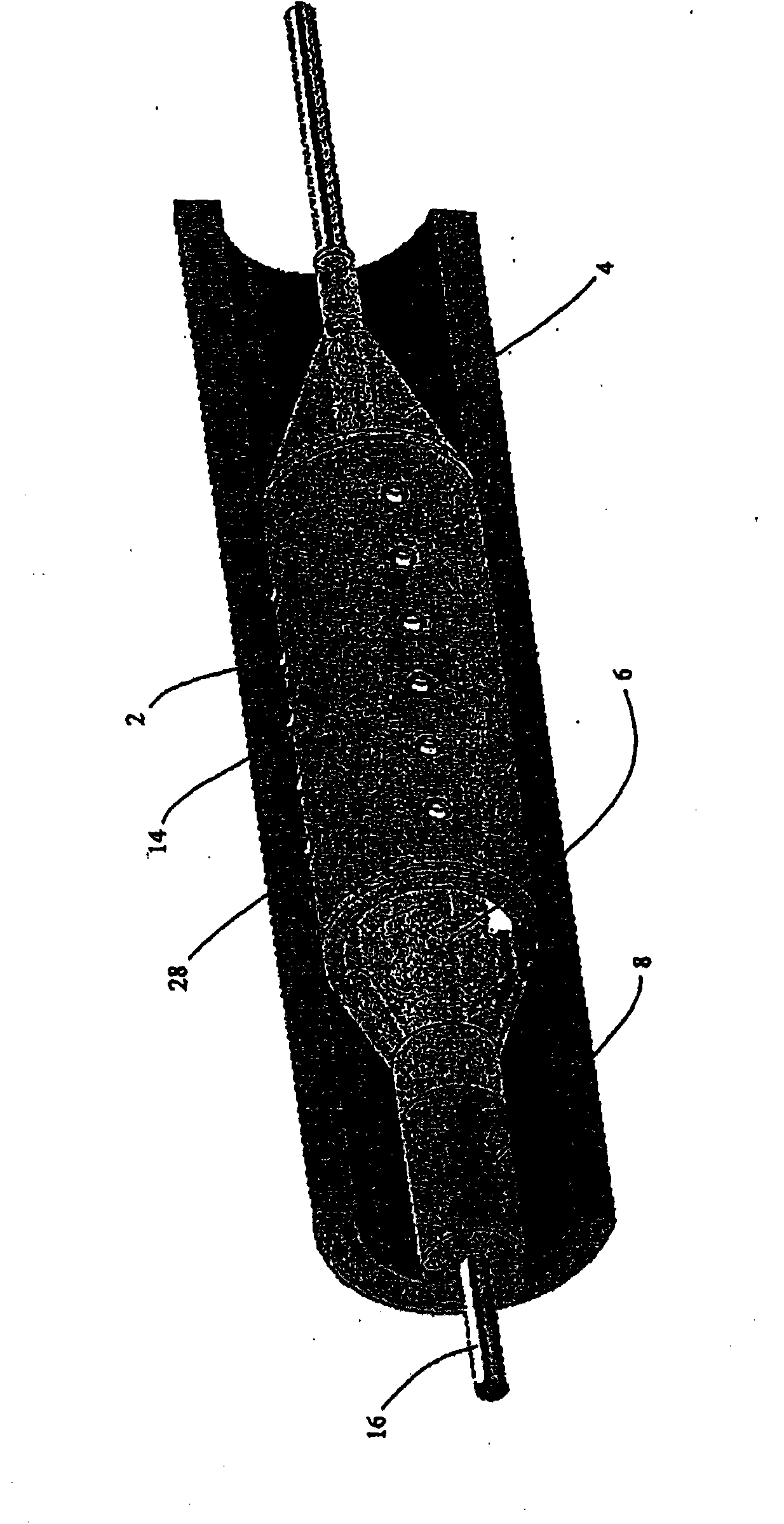 Minimally invasive intravascular treatment device