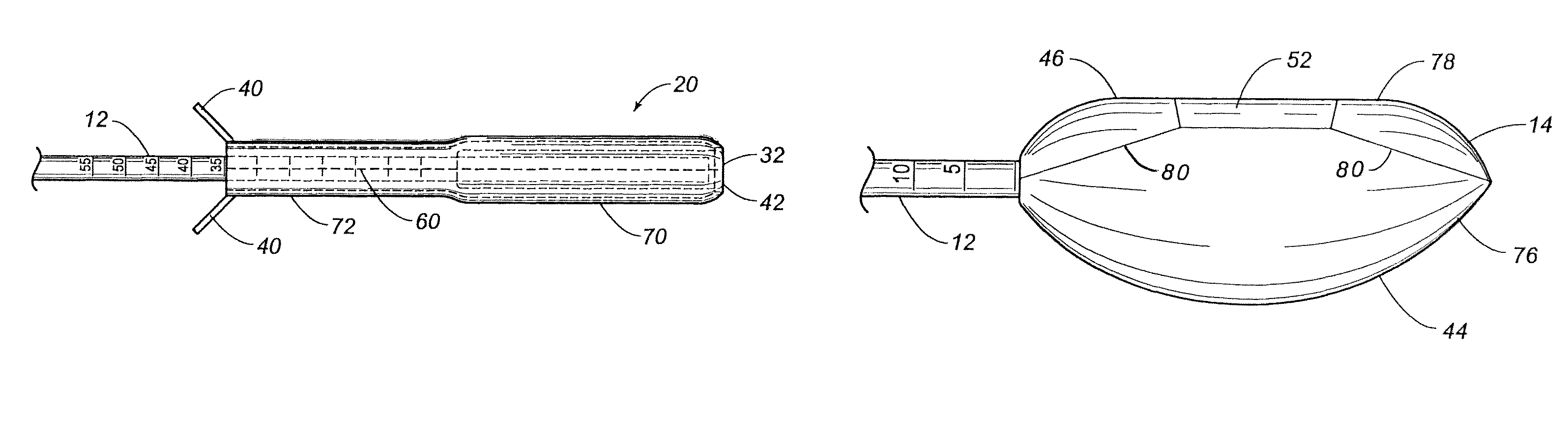 Minimally invasive rectal balloon apparatus