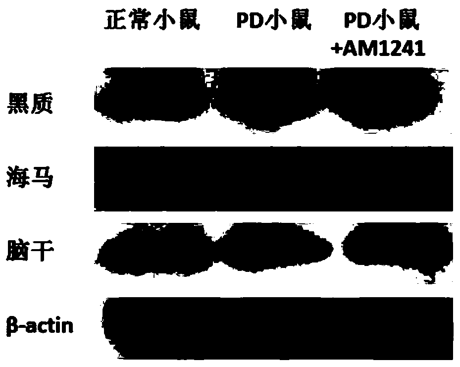 Application of a compound in preparation of medicine for treating Parkinson's disease