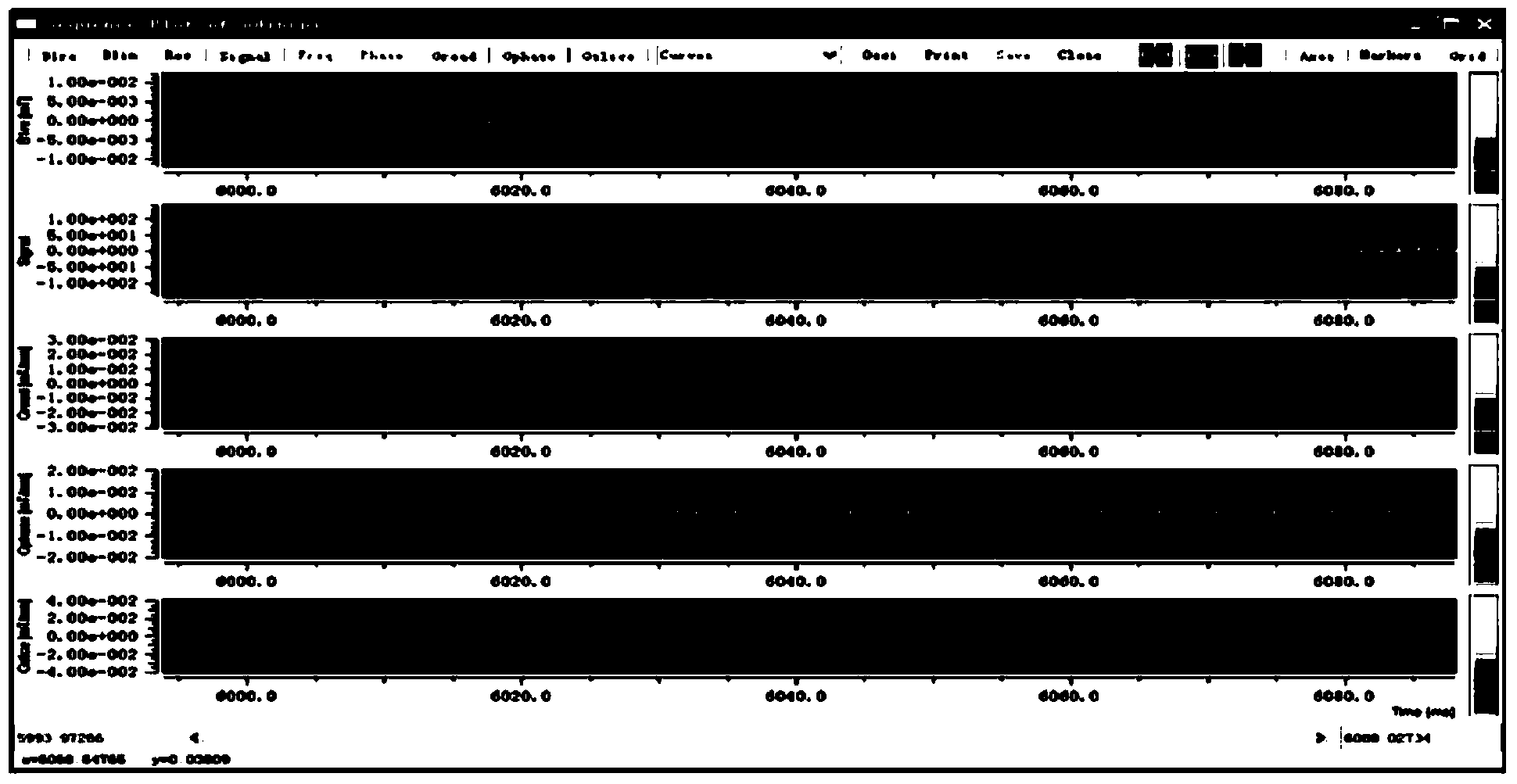 Production method for quick imaging sequence single-short EPI-SSFP (Echo Planar Imaging-Steady-State Free Procession)