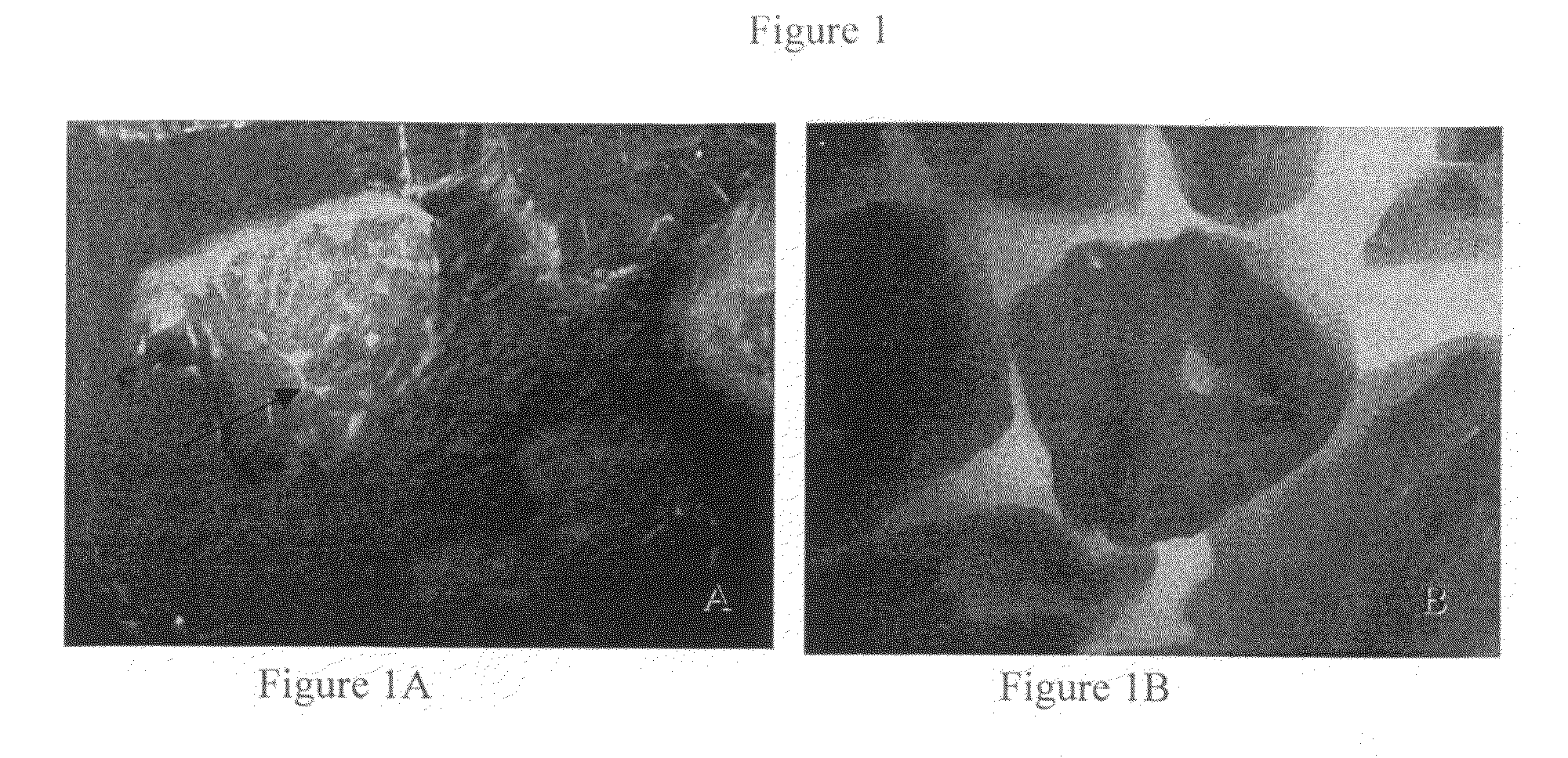 Autologous dental pulp stem cell-based bone graft substitute