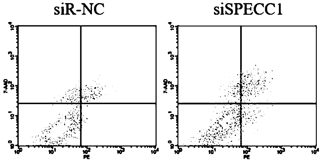 CircSPECC1 for treating human kidney cancer and application thereof