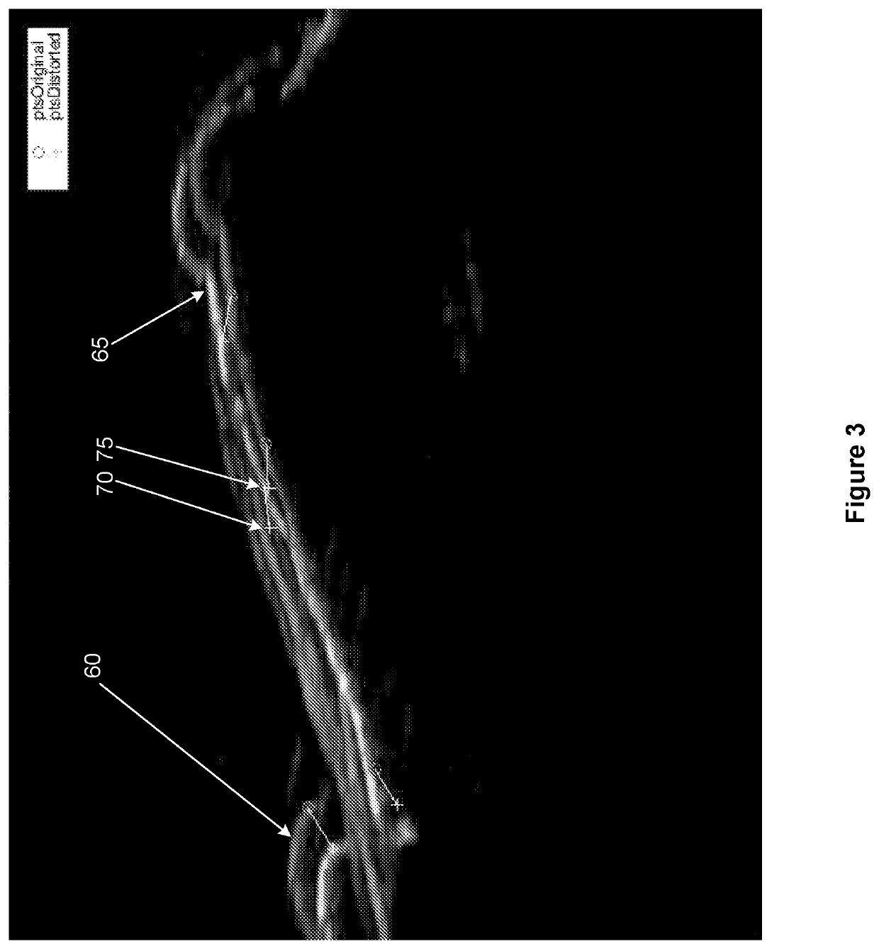 Method and device for measuring anatomical movement of a joint