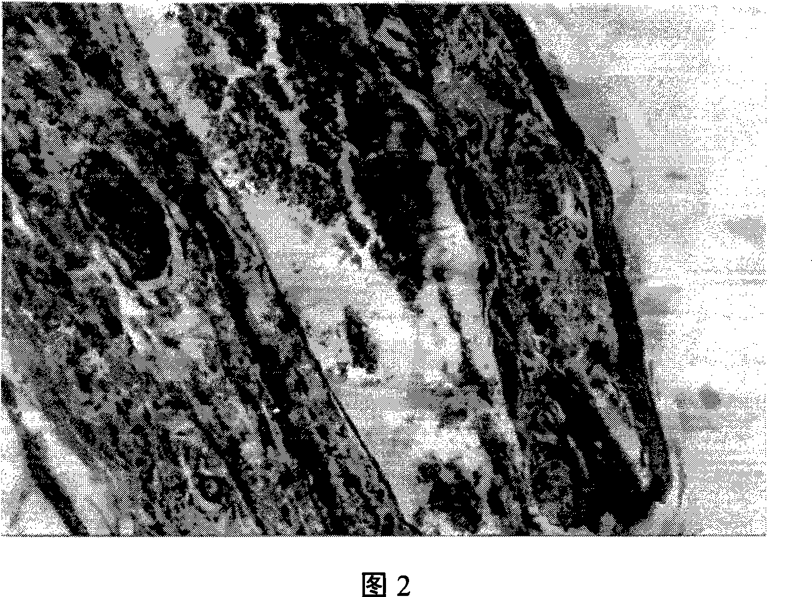 'Yanhuning' frozen-dried powder injection and its preparation method